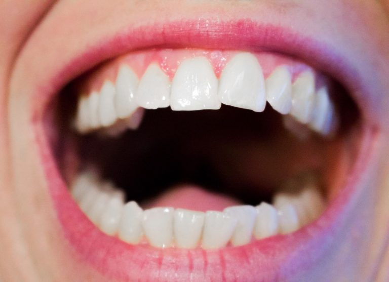 Aktualna technologia używana w salonach stomatologii estetycznej być może spowodować, że odzyskamy śliczny uśmiech.